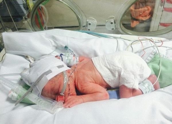 Врачи потеряли ребенка в животе беременной прямо во время родов