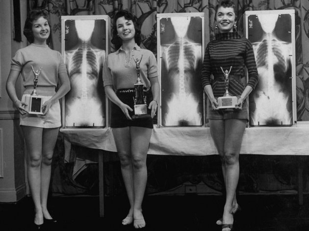 Как в 1956 году выбирали Мисс правильная осанка. Фото