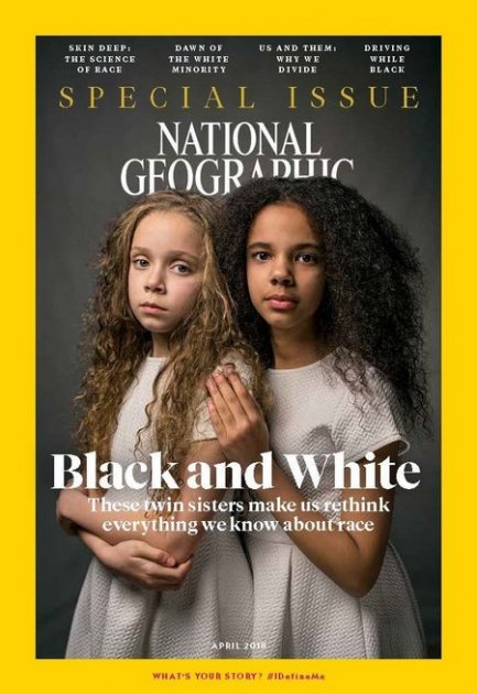 National Geographic разместила на обложке необычных близняшек. Фото