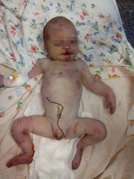 У мережі шоковані звірячим побиттям новонародженого на Миколаївщині. Фото